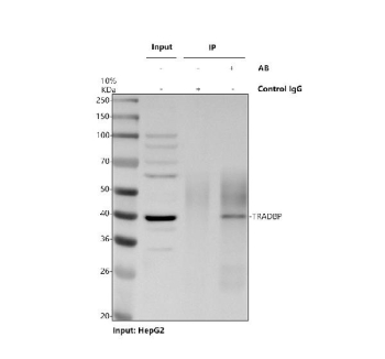 TARDBP Antibody IP. Immunoprecipitation of TARDBP protein from 500ug of human HepG2 whole cell lysate with 2ug of TARDBP antibody.