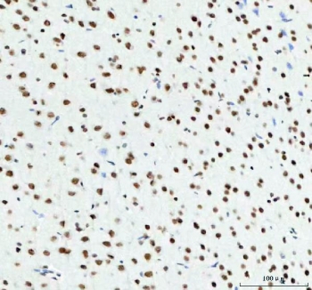 TARDBP Antibody Rat Brain Tissue Immunohistochemistry. IHC staining of FFPE rat brain tissue with TARDBP antibody. HIER: boil tissue sections in pH8 EDTA for 20 min and allow to cool before testing.