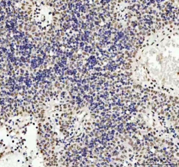 TARDBP Antibody Spleen Immunohistochemistry. IHC staining of FFPE human spleen tissue with TARDBP antibody. HIER: boil tissue sections in pH8 EDTA for 20 min and allow to cool before testing.