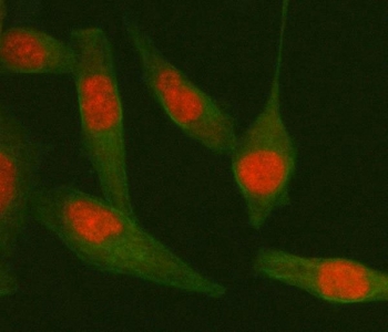TARDBP Antibody HeLa Cell IF. Immunofluorescent staining of FFPE human HeLa cells with TARDBP antibody (red) and Beta Tubulin mAb (green). HIER: steam section in pH6 citrate buffer for 20 min.
