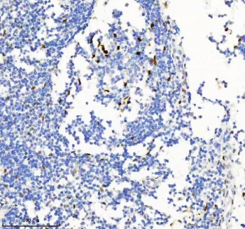 IHC staining of FFPE human tonsil tissue with MACROH2A2 antibody. HIER: boil tissue sections in pH8 EDTA for 20 min and allow to cool before testing.