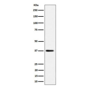 MRPS31 Antibody 29M40 in Human HepG2 Liver Cancer Cells WB. Western blot testing of human HepG2 hepatocellular carcinoma cell lysate with MRPS31 Antibody 29M40 / Mitochondrial Ribosomal Protein S31 Antibody, clone 29M40. A specific band is observed at approximately 38 kDa. The predicted molecular weight of MRPS31 is approximately 45 kDa.