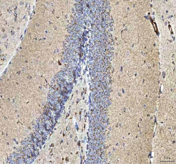 IHC staining of FFPE mouse brain tissue with HCRT antibody. HIER: boil tissue sections in pH8 EDTA for 20 min and allow to cool before testing.