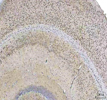 IHC staining of FFPE mouse brain tissue with HCRT antibody. HIER: boil tissue sections in pH8 EDTA for 20 min and allow to cool before testing.