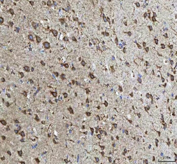 IHC staining of FFPE rat brain tissue with HCRT antibody. HIER: boil tissue sections in pH8 EDTA for 20 min and allow to cool before testing.