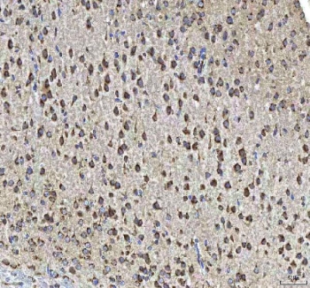 IHC staining of FFPE mouse brain tissue with HCRT antibody. HIER: boil tissue sections in pH8 EDTA for 20 min and allow to cool before testing.