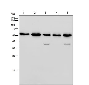 Western blot testing of human 1) HeLa, 2) Jurkat, 3) HePG2, 4) MCF7 and 5) SH-SY5Y cell lysate with NUP50 antibody. Expected molecular weight: 50-60 kDa.
