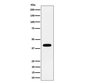 Western blot testing of human HeLa cell lysate with SCAD antibody. Predicted molecular weight ~44 kDa.