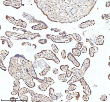 IHC staining of FFPE human placental tissue with MIPEP antibody. HIER: boil tissue sections in pH8 EDTA for 20 min and allow to cool before testing.