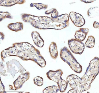 IHC staining of FFPE human placental tissue with MIPEP antibody. HIER: boil tissue sections in pH8 EDTA for 20 min and allow to cool before testing.