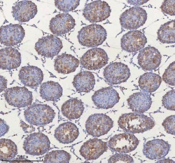 IHC staining of FFPE rat testis tissue with MIPEP antibody. HIER: boil tissue sections in pH8 EDTA for 20 min and allow to cool before testing.
