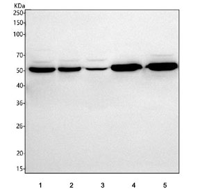 Western blot testing of 1) human Caco-2, 2) human 293T, 3) human Jurkat, 4) rat brain and 5) mouse brain tissue lysate with HDHD5 antibody. Predicted molecular weight ~46 kDa.