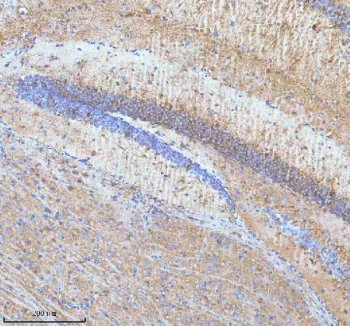 IHC staining of FFPE mouse hippocampus tissue with HDHD5 antibody. HIER: boil tissue sections in pH8 EDTA for 20 min and allow to cool before testing.