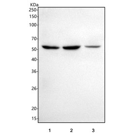 Western blot testing of human 1) U-87 MG, 2) U-251 and 3) U-2 OS cell lysate with SLITRK1 antibody. Predicted molecular weight ~78 kDa, observed here at ~55 kDa.