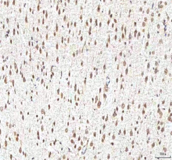 IHC staining of FFPE human rat brain tissue with PHF6 antibody. HIER: boil tissue sections in pH8 EDTA for 20 min and allow to cool before testing.
