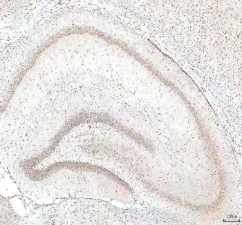 IHC staining of FFPE human rat brain tissue with PHF6 antibody. HIER: boil tissue sections in pH8 EDTA for 20 min and allow to cool before testing.