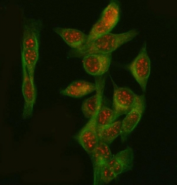 Immunofluorescent staining of FFPE human HeLa cells with Phosphoglucomutase 3 antibody (red) and Beta Tubulin mAb (green). HIER: steam section in pH6 citrate buffer for 20 min.