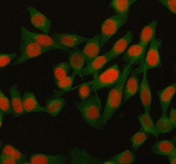 Immunofluorescent staining of FFPE human HeLa cells with MACROH2A1 antibody (red) and Beta Tubulin mAb (green). HIER: steam section in pH6 citrate buffer for 20 min.