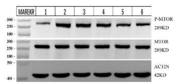 Phospho-mTOR (pSer2448) Antibody 4T1 WB. Western blot analysis of mouse 4T1 cell lysates including untreated, LPS-stimulated, and drug-treated conditions using phospho-mTOR antibody detecting mTOR phosphorylated at Ser2448, clone IFF-13. Lane 1: untreated, Lane 2: LPS-stimulated, Lane 3-5: increasing drug doses, Lane 6: positive control drug. A band is detected at approximately 289 kDa, consistent with the predicted molecular weight of mTOR. Phospho-mTOR levels vary across treatment conditions, reflecting modulation of mTOR pathway activity. Total mTOR and Actin are shown as controls.
