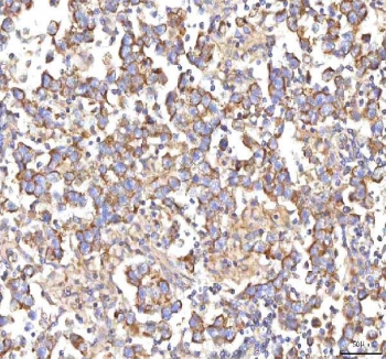 IHC staining of FFPE human testicular seminoma tissue with HSDL2 antibody. HIER: boil tissue sections in pH8 EDTA for 20 min and allow to cool before testing.