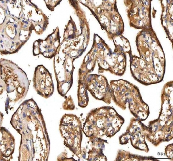 IHC staining of FFPE human placental tissue with Peptide deformylase antibody. HIER: boil tissue sections in pH8 EDTA for 20 min and allow to cool before testing.