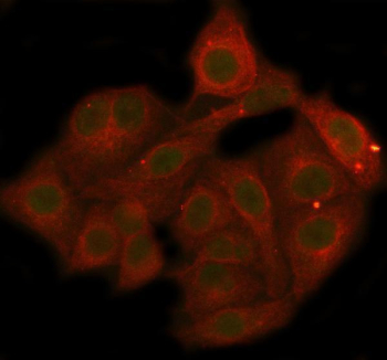 Phospho-AKT1 (pT450) Antibody A549 IF. Immunofluorescence analysis of FFPE human A549 cells using phospho-AKT1 (pT450) antibody (green) shows cytoplasmic and nuclear signal consistent with phosphorylation at the T450 turn motif, while Beta Actin (red) highlights the cytoskeletal network; nuclei are counterstained with DAPI (blue). Detection was performed with clone HEA-1. HIER: steam sections in pH6 citrate buffer for 20 min.