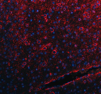 Immunofluorescent staining of FFPE mouse brain tissue with SLC39A10 antibody (red) and DAPI nuclear stain (blue). HIER: steam section in pH8 EDTA buffer for 20 min.