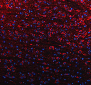 Immunofluorescent staining of FFPE rat brain tissue with SLC39A10 antibody (red) and DAPI nuclear stain (blue). HIER: steam section in pH8 EDTA buffer for 20 min.