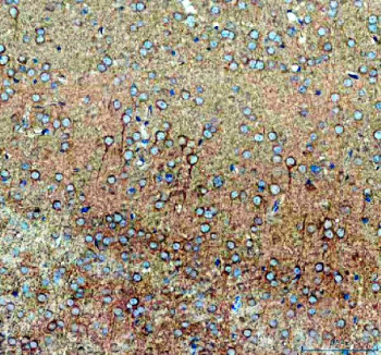 IHC staining of FFPE mouse brain tissue with SLC39A10 antibody, HRP-secondary and DAB substrate. HIER: boil tissue sections in pH8 EDTA for 20 min and allow to cool before testing.