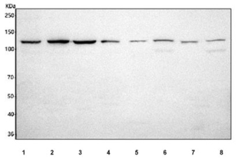 Western blot testing of 1) human SiHa, 2) human HeLa, 3) human Caco-2, 4) human RT4, 5) rat liver, 6) rat brain, 7) mouse liver and 8) mouse brain tissue lysate with IPO9 antibody. Predicted molecular weight ~116 kDa, but it is often observed at higher molecular weights due to protein complexing.