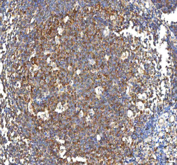 IHC staining of FFPE human tonsil tissue with PFKP antibody. HIER: boil tissue sections in pH8 EDTA for 20 min and allow to cool before testing.