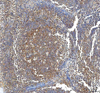 IHC staining of FFPE human tonsil tissue with PFKP antibody. HIER: boil tissue sections in pH8 EDTA for 20 min and allow to cool before testing.