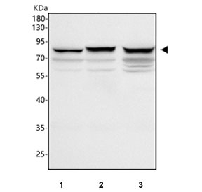 Western blot testing of human 1) 293T, 2) Jurkat and 3) MCF7 cell lysate with PFKP antibody. Predicted molecular weight ~86 kDa.