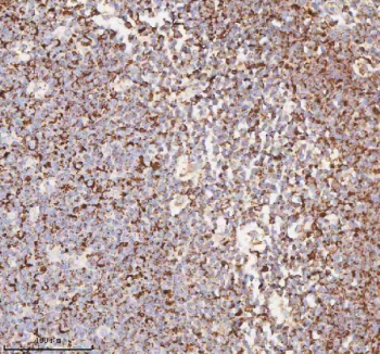 IHC staining of FFPE human tonsil tissue with IRS4 antibody. HIER: boil tissue sections in pH8 EDTA for 20 min and allow to cool before testing.