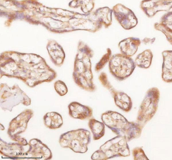 IHC staining of FFPE human placental tissue with SLK antibody. HIER: boil tissue sections in pH8 EDTA for 20 min and allow to cool before testing.