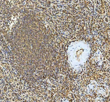 IHC staining of FFPE human spleen tissue with SMIM8 antibody. HIER: boil tissue sections in pH8 EDTA for 20 min and allow to cool before testing.