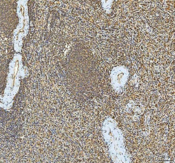 IHC staining of FFPE human spleen tissue with SMIM8 antibody. HIER: boil tissue sections in pH8 EDTA for 20 min and allow to cool before testing.