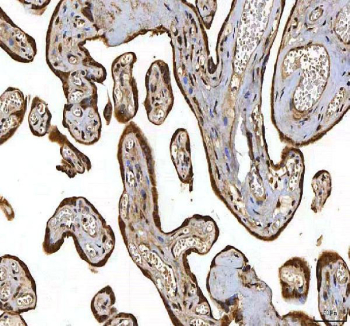 IHC staining of FFPE human placental tissue with SMIM8 antibody. HIER: boil tissue sections in pH8 EDTA for 20 min and allow to cool before testing.