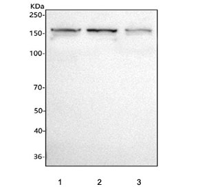 Western blot testing of human 1) MOLT4, 2) K562 and 3) Jurkat cell lysate with CD127 antibody. Predicted molecular weight: 52-90 kDa depending on level of glycosylation; the dimer form is observed at ~150 kDa.