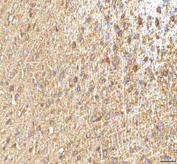 IHC staining of FFPE rat brain tissue with Hcn2 antibody. HIER: boil tissue sections in pH8 EDTA for 20 min and allow to cool before testing.