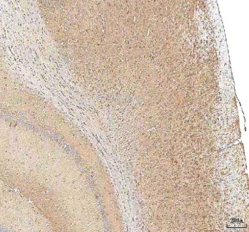IHC staining of FFPE rat brain tissue with Hcn2 antibody. HIER: boil tissue sections in pH8 EDTA for 20 min and allow to cool before testing.
