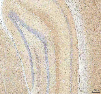 IHC staining of FFPE rat brain tissue with Hcn2 antibody. HIER: boil tissue sections in pH8 EDTA for 20 min and allow to cool before testing.