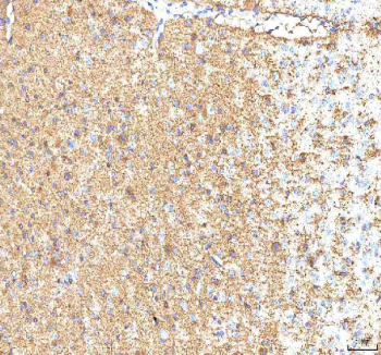 IHC staining of FFPE mouse brain tissue with Hcn2 antibody. HIER: boil tissue sections in pH8 EDTA for 20 min and allow to cool before testing.