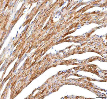 IHC staining of FFPE mouse cardiac tissue with Hcn2 antibody. HIER: boil tissue sections in pH8 EDTA for 20 min and allow to cool before testing.