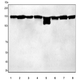 Western blot testing of 1) human A549, 2) human 293T, 3) human Jurkat, 4) human HepG2, 5) rat liver, 6) rat RH35, 7) mouse liver and 8) mouse NIH 3T3 cell lysate with HDLBP antibody. Predicted molecular weight ~141 kDa.