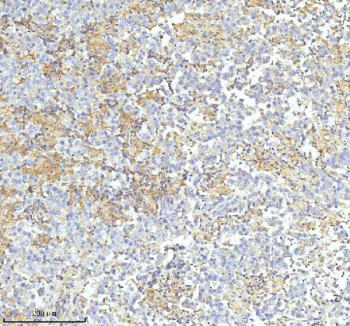 IHC staining of FFPE human testicular seminoma tissue with HDHD2 antibody. HIER: boil tissue sections in pH8 EDTA for 20 min and allow to cool before testing.