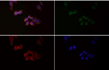 Immunofluorescent staining of FFPE human HeLa cells with Phospho-HSF1 antibody (green), Phalloidin (red) and DAPI nuclear stain (blue). HIER: steam section in pH6 citrate buffer for 20 min.