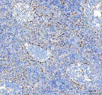 IHC staining of FFPE human spleen tissue with Phospho-HSF1 antibody. HIER: boil tissue sections in pH8 EDTA for 20 min and allow to cool before testing.