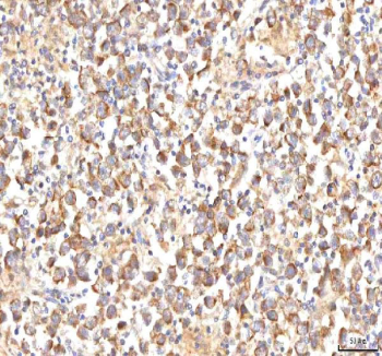 IHC staining of FFPE human testicular seminoma tissue with MANSC4 antibody. HIER: boil tissue sections in pH8 EDTA for 20 min and allow to cool before testing.