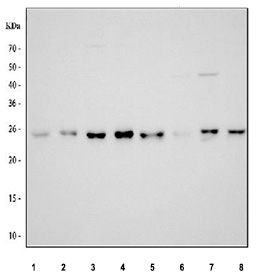 Western blot analysis using RPE antibody. Lane 1: human 293T whole cell lysates; Lane 2: human HeLa whole cell lysates; Lane 3: human K-562 whole cell lysates; Lane 4: human HepG2 whole cell lysates; Lane 5: rat thymus tissue lysates; Lane 6: rat RH35 whole cell lysates; Lane 7: mouse thymus tissue lysates; Lane 8: mouse NIH/3T3 whole cell lysates. The predicted molecular weight of Ribulose-phosphate 3-epimerase is ~25 kDa. A predominant band is observed near the expected size across samples, with minor variation in apparent molecular weight consistent with context-dependent electrophoretic behavior.